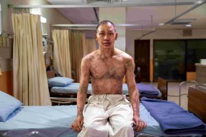ปากกัด ตีนถีบ 1